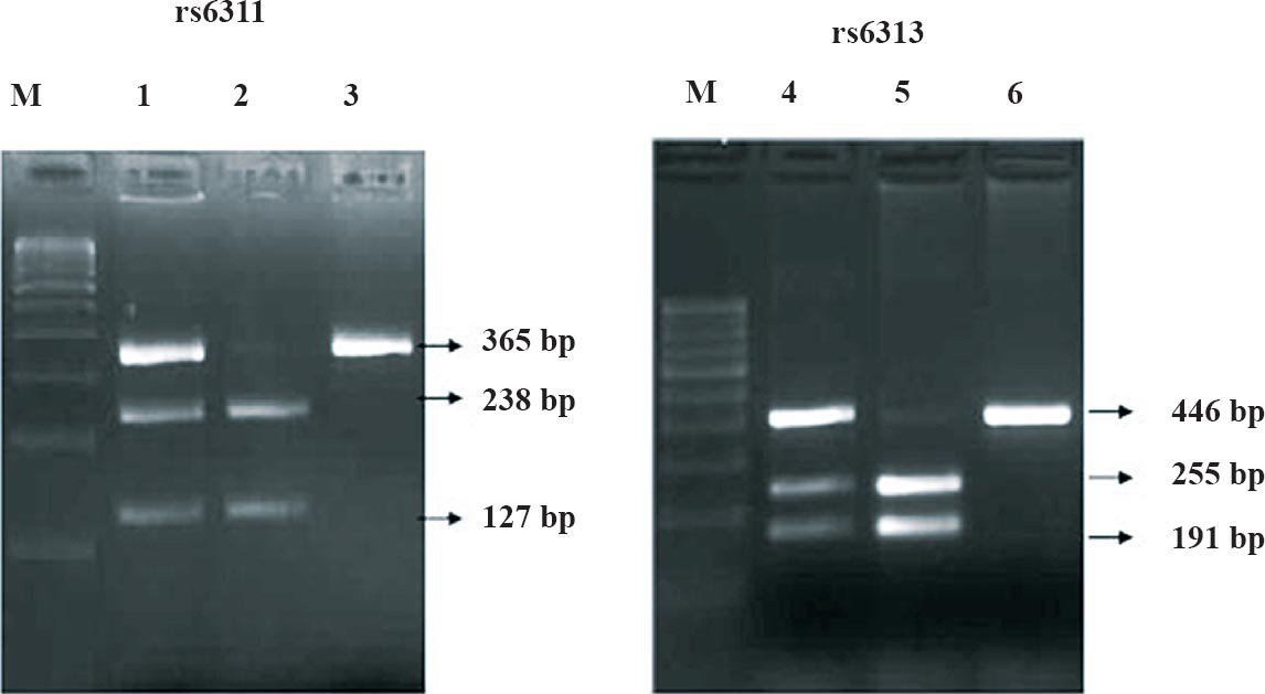 RFLP products of rs6311 and rs6313. M, 100bp ladder; Lane 1, AG genotype; Lane 2, GG genotype; Lane 3, AA genotype; Lane 4, TC genotype; Lane 5, CC genotype; Lane 6, TT genotype
