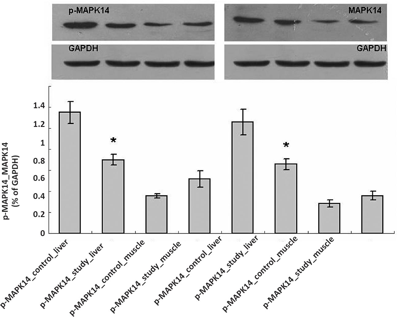 MAPK14 protein expression in liver and muscle. Control, control group; Study, diabetic group; the values are mean ± SD (n = 3). *P<0.05 study group vs. control group; MAPK14, mitrogen-activated protein kinase 14; p-MAPK14, phospho - MAPK14; GAPDH, glyceraldehyde-3-phosphate dehydrogenase.