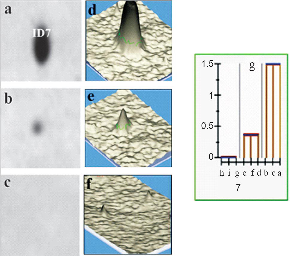 Gel portion showing differential expression of spot ID7 of hypobaric hypoxia exposed Sprague Dawley rats; (a) tolerant: showing increased expression of protein spot ID7; (d) 3D peak representation of (a); (b) susceptible: showing low expression of spot ID7; (e) 3D peak representation of (b); (c) normal: showing absence of protein spot ID7; (f) 3D peak representation of (c); (g) histogram showing comparison of expression of protein spot ID7 in tolerant, susceptible and normal samples. X-axis represents samples (bar ‘bca’ represents tolerant; bar ‘efd’ represents susceptible; bar ‘hig’ represents normal) and Y-axis, corresponds to the relative spot intensity in arbitrary unit. 3D peak and histograms were generated using ImageMaster™ 2D Platinum 7.0 software. As per the user manual of ImageMaster™ 2D Platinum 7.0 software, in the histograms the vertical orange bars correspond to the spot values, the blue horizontal line represents the chosen central tendency and the red lines delimit the range defined by [Central value – Dispersion, Central value + Dispersion], and the match ID is displayed at the bottom of each histogram.