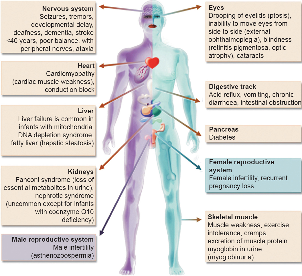 Schematic picture showing the clinical features and the organs affected by mitochondrial diseases. Additional information is also given in the Table.