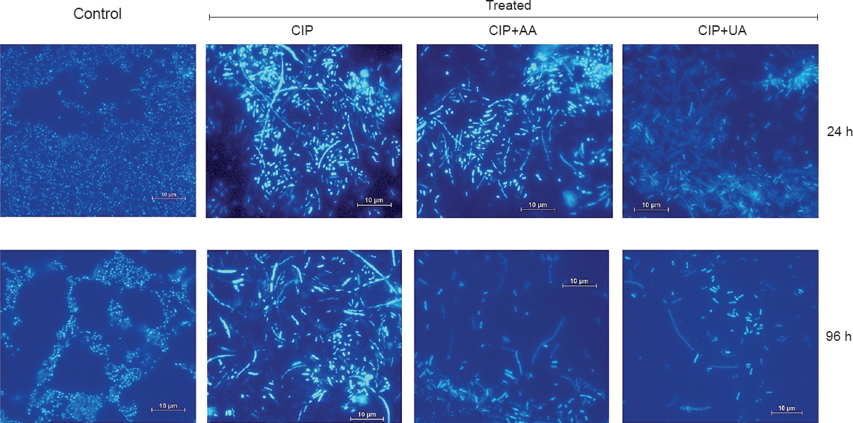 Fluorescence microscopy images (×1000) revealing the antibiofilm ability of CIP, CIP+AA, CIP+UA against clinical UPECs. CIP, ciprofloxacin; AA, asiatic acid; UA, ursolic acid.