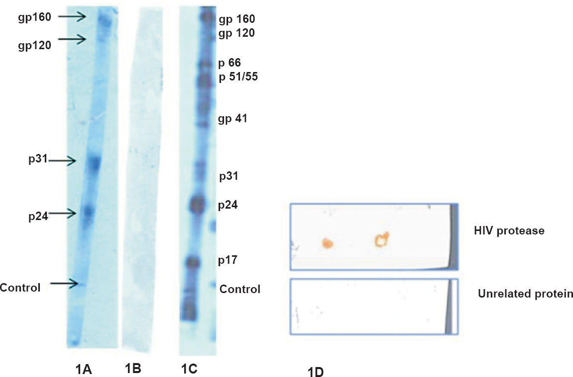 (A). Bands of HIV proteins (gp160, gp120, p31, p24) interacting with cys C. (B). No bands were seen with an unrelated protein treated similarly (C). Bands visualized with HIV-positive serum only are shown (D). Interaction of cys C with HIV protease by dot blot. No binding was observed with an unrelated protein.