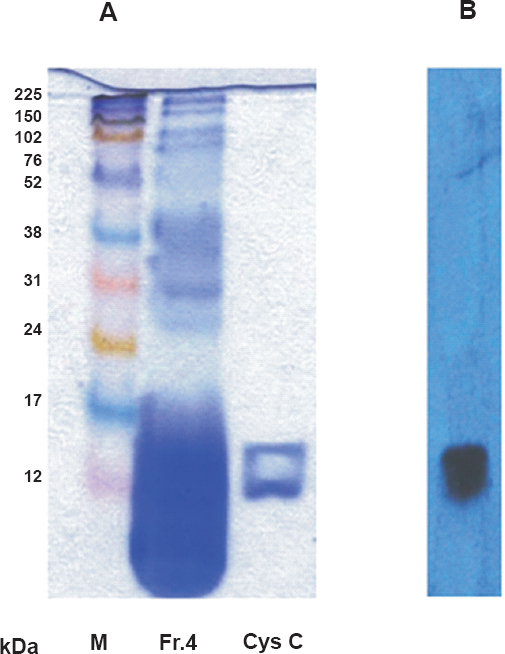 (A). demonstrates the band(s) of purified cystatin C from fraction 4 of human seminal plasma proteins purified by gel-permeation chromatography and by western blotting using specific antibodies to cys C (B).
