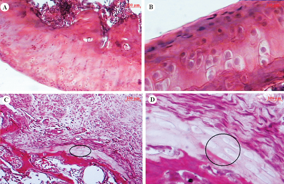Hematoxylin and eosin stained femoral articular cartilage of naïve control rats (A, 10x; B, 40x) showing the normal histology having smooth surface with intact superficial mid and deep zones, whereas vehicle-treated MIA rats cartilage (C, 10x; D, 40x) showing severely damaged cartilage with widespread cell necrosis, replaced with fibrocartilage (circle), irregularly arranged and clustering of chondrocytes.