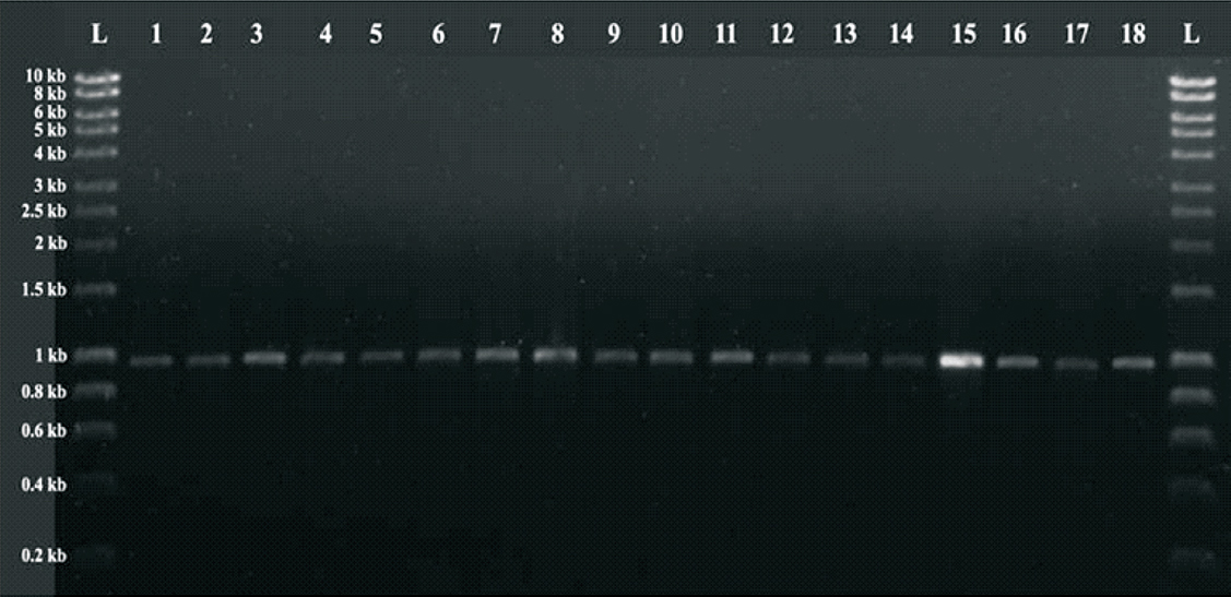 PCR amplified product of blaPER-1. L: Hyper ladder I (Bioline; UK); 1-18: 920 bp PCR amplified product of blaPER-1.