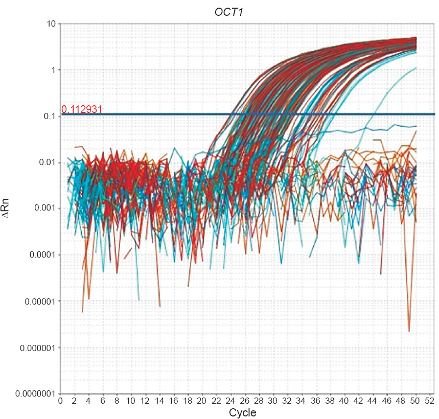 Amplification plot of OCT1 gene of CML patients.