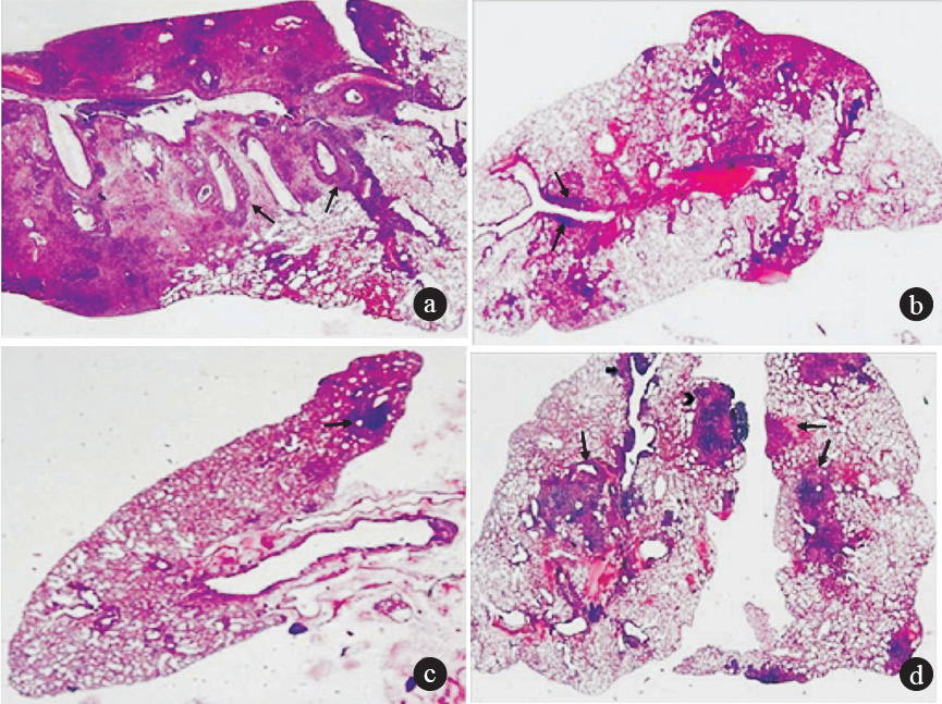Light photomicrographs of lung sections from mice infected with MDR-TB strain JAL-7782 with haematoxylin-eosin stain. (a) Positive control: An almost complete lobar pneumonia consolidation by tuberculous granulation tissue including pale staining histiocytes and dark clusters of lymphocytes and peribronchial lymphocytic cuffing (arrow) (Grade 0; maximum consolidation) (b) MOX treated: Lung showing fairly large area of consolidation by fat tuberculous pneumonia, both in the central and peripheral zone. Small focus of lymphocytic cuffing around bronchi (arrows). (Grade II moderate consolidation) (c) ECZ treated: Nearly normal lung with a tiny focus of lymphocytes and pale histiocytes (arrow). The central zone shows collapse and some interstitial inflammation. Grade 0: minimum consolidation. (d) Both lungs show focal areas of consolidation by tuberculous inflammation (arrows). There is a large peripheral sub pleural focus, an irregular zone at the hilum and a peribronchial cuffing by lymphoid cells (arrow). (grade III; focal areas of consolidation) (magnification 20x).