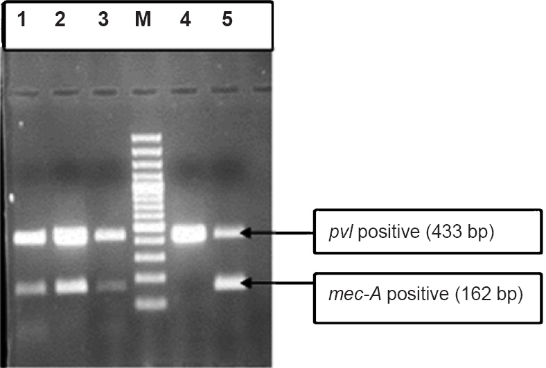 Duplex PCR (mec-A and pvl gene). Lanes 1,2,3,5 = Positive mec-A (162bp) and pvl (433bp), M= Marker (100bp DNA ladder), Lane 4 =Negative mec-A (162bp) positive pvl (433 bp).