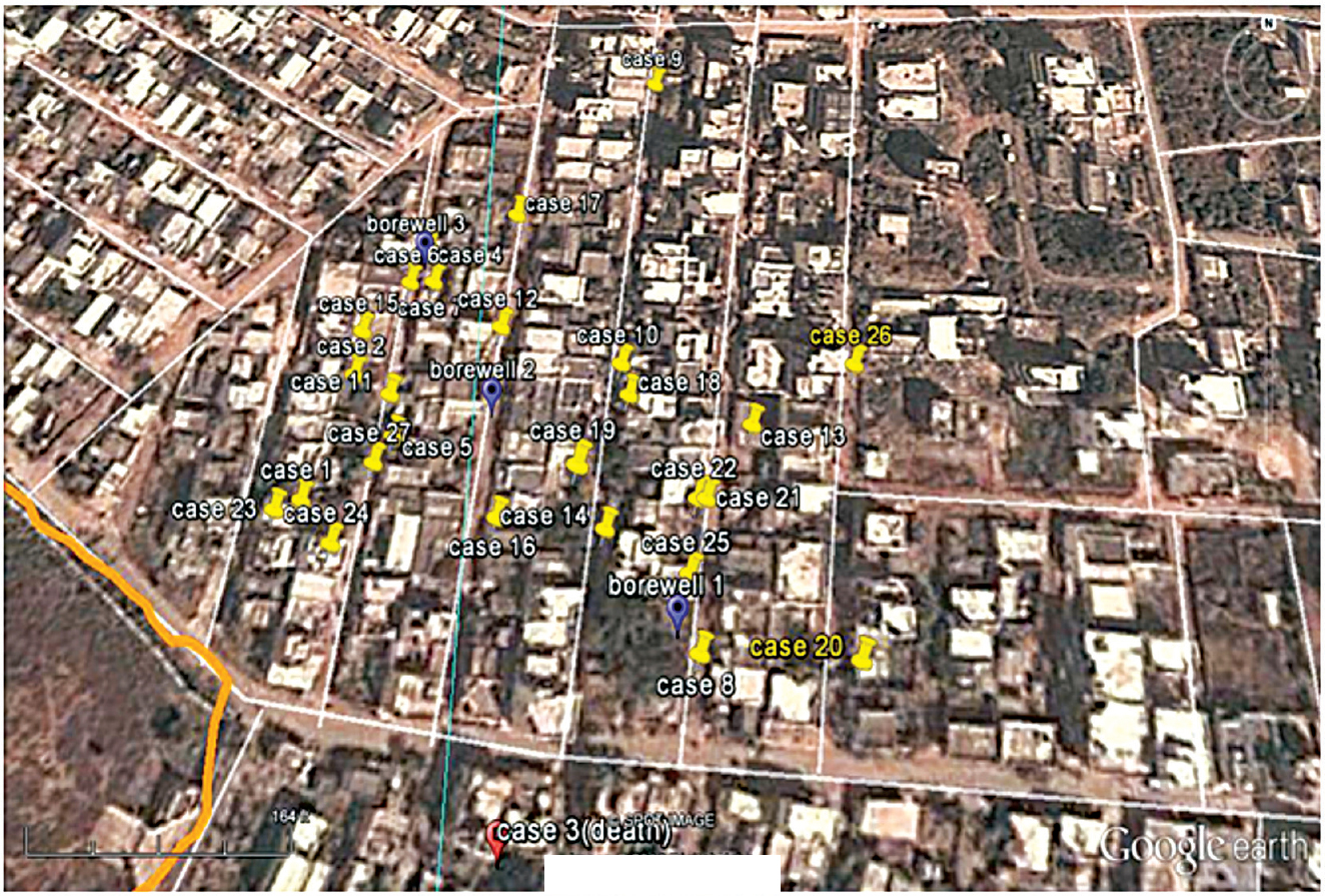 Spot map showing spatial distribution of the cases using GPS and Google Earth.