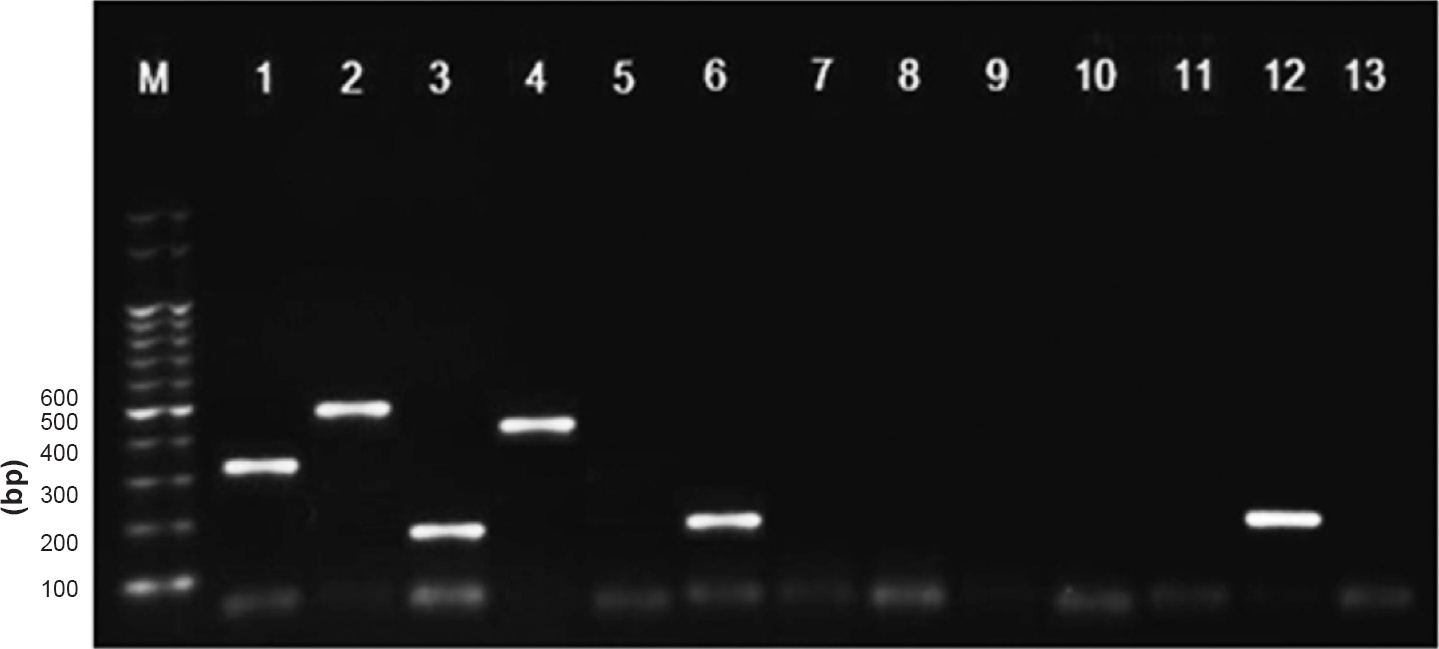 Results of multiplex reverse-transcription (RT)-PCR with clinical samples and controls. Lane M, Marker; Lane 1, HPIV-1(Positive control); Lane 2, HPIV-2(PC); Lane 3, HPIV-3(PC); Lane 4, HPIV4(PC); Lane 5, Negative; Lane 6, HPIV3(clinical sample); Lanes 7 to 11, Negative; Lane 12, HPIV-3 (clinical sample); Lane 13, Negative control