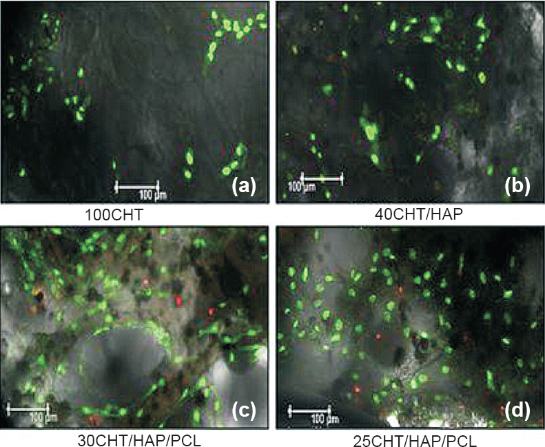 Confocal laser microscopic images of hMSCs grown on scaffolds after seven days (a) cells were randomly distributed and forming patch on 100CHT, (b) hMSCs adhered and attained fibroblastic morphology on 40CHT/HAP, (c, d) Cells were more evenly distributed over 30CHT/HAP/PCL and 25CHT/HAP/PCL, covered whole surface of the scaffold. Viability and distribution of cells were detected using fluorescence markers that allowed life/death stain (FDA/PI): dead cells were stained red whereas viable cells were stained green (Magnification 10X).