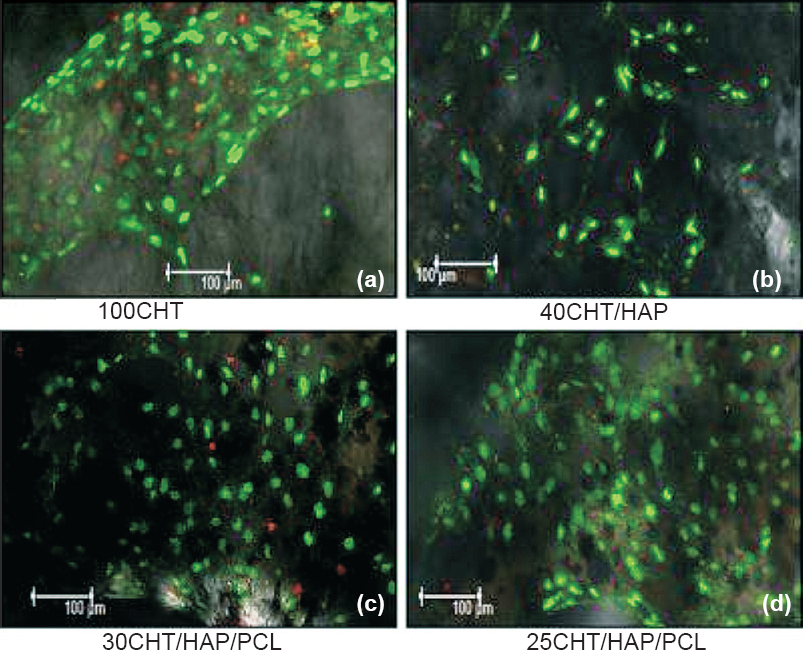 Confocal laser microscopic images of hMSCs grown on scaffolds after 14 days. (a) Cells proliferated and form a large patch on 100CHT, (b) Cells increased in number and evenly distributed on 40CHT/HAP, (c, d) Cells proliferated and their number increased from day 7 to 14. Cells were connected to each other and formed a cell network across the surface of 30CHT/HAP/PCL and 25CHT/HAP/PCL scaffolds. Viability and distribution of cells were detected using fluorescence markers that allowed life/death stain (FDA/PI): dead cells were stained red whereas viable cells were stained green. The qualitative image analysis revealed that a larger number of cells stayed viable throughout the entire culture period. (Magnification 10X).