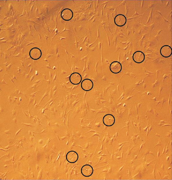 This is Figure 1 of the article by Bhansali et al1 showing VSELs (encircled) which have been missed out possibly because of the very small size. These cells have been ignored till now but are pluripotent stem cells that survive in various adult tissues throughout life. Source: Ref. 1 (Reproduced with permission).