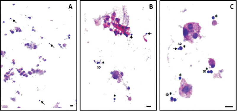 Haematoxylin & Eosin (H&E) stained smears of cells from normal mouse pancreas to appreciate the very small size of VSELs (arrow) at 10X, 20X and 40X. Cells marked in asterix are the pancreas specific progenitors. Source: Ref. 5 (Reproduced with permission).