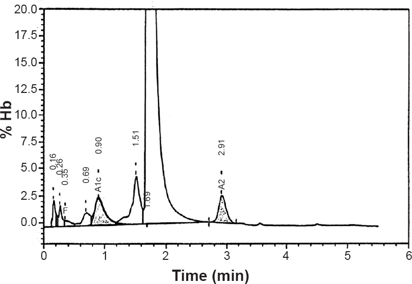 Elution haemoglobin chromatogram of patient II-3 specimen on Bio-Rad Variant V HPLC System. Time (min) represents the retention time in minutes for each fraction to elute; % Hb represents the percentage of haemoglobin in the elution peak. The retention time for each fraction is shown with the peak. HbA2 (2.6%) was eluted at a retention time of 2.91, HbF (0.5%) at a retention time of 0.35 min. The two earliest peaks of retention time 0.16 and 0.26 min correspond to HbA1a and HbA1b, respectively.