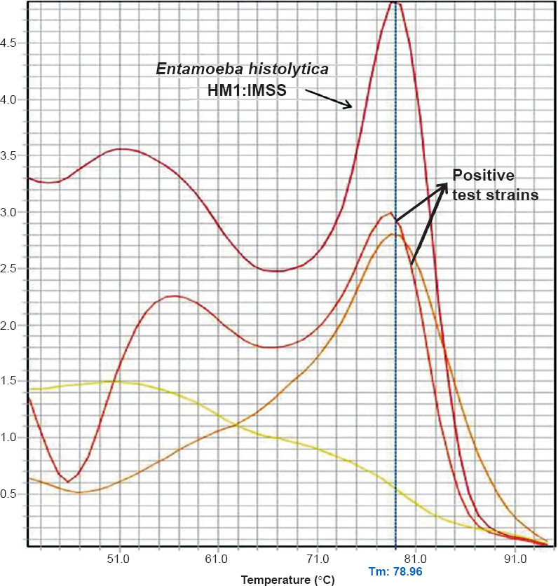 Melting curve analysis of the amplified products obtained in the SYBR Green real-time PCR assay. Entamoeba histolytica HM1:IMSS:- Reference strain used as positive control (Tm-78.96°C); Tm-Melting temperature of the amplicon. Melting temperature curves of the amplicons from positive test samples are indicated with an arrow.
