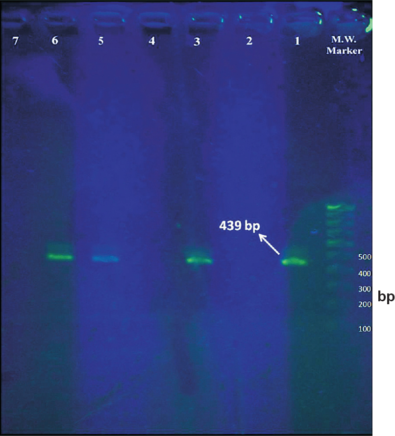 Agarose gel electrophoresis of amplified products from SYBR Green real-time PCR assay (without ethidium bromide staining). M.W. marker - 100 bp DNA molecular weight marker, Lane 1 - Positive control (amplicon size - 439 bp), Lane 2 - Negative control, Lanes 3, 5 and 6 - Positive test samples (439 bp - E. histolytica), Lanes 4 and 7 - Negative test samples.