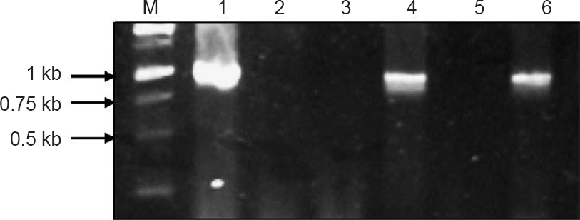 Representative gel picture of PCR amplification of 16S rRNA gene (996 bp) from different samples. M-1 kb DNA ladder. Lane 1-Positive control; Lane 2-Negative control; Lanes 3-6, different blood samples.