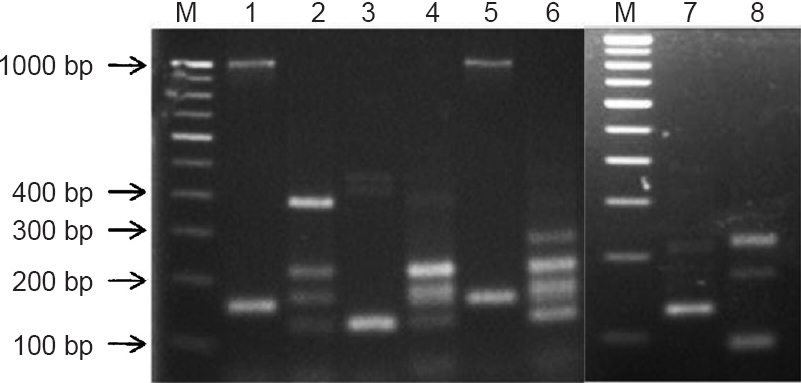 PCR-RFLP photograph of 16S rRNA gene amplicon of reference strains. M: 100 bp DNA ladder Lane 1: Staphylococcus aureus; Lane 2: Pseudomonas aeruginosa; Lane 3: Enterococcus faecalis; Lane 4: Klebsiella pneumoniae; Lane 5: Staphylococcus epidermidis; Lane 6: Enterobacter aerogenes; Lane 7: Acinetobacter baumannii; Lane 8: Group-B Streptococcus.