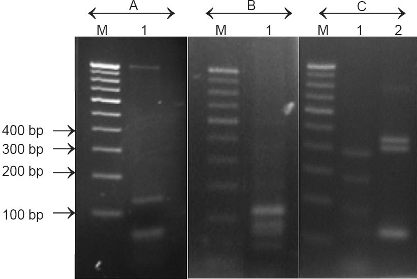 Representative gel picture of RFLP pattern of different samples. M-100 bp DNA ladder. (A) Lane-1, Staphylococcus aureus (B) Lane-1, Klebsiella pneumoniae (C) Lane-1, Pseudomonas aeruginosa (C) Lane-2, Enterococcus faecalis.