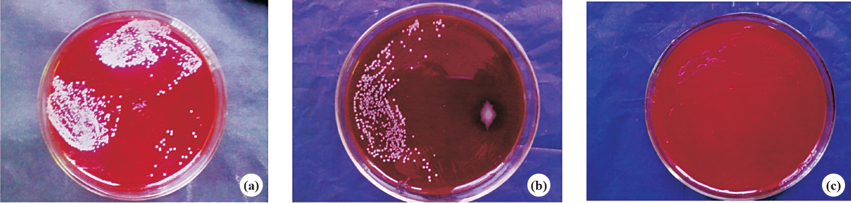Pus culture showing positive result in 2nd (a) and 5th (b) week, negative result in 7th week (c) in group B rabbits.