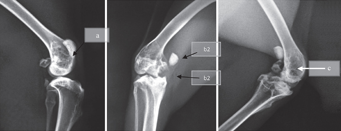 X-ray of group C rabbits showing sclerosis and osteolysis at 3rd week (a), periosteal reaction with sequestrum formation (b1) and arthritis (b2) at 5th week, similar features but decrease in sclerosis and ostelysis at 7th week (c).