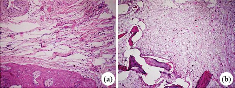 Histopathological slides of group C rabbits showing minimal inflammation at 3rd week (a) and no inflammation with new formation at 6th week (b). Stain H & E, magnification 10x.