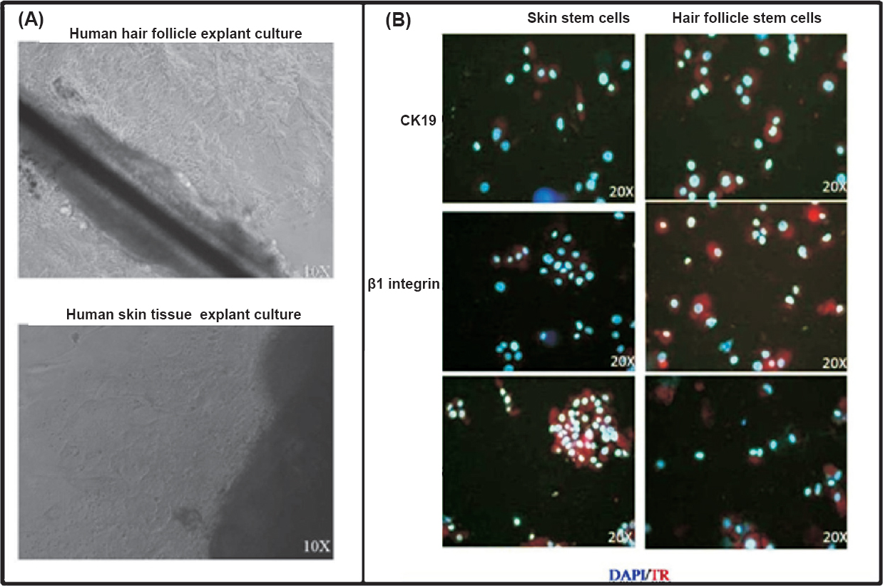 Expansion and charcaterization of skin and hair follicle stem cells. (A). Photomicrograph showing the explant culture of hair and skin tissue over fibronectin coated culture dish. The cells started coming out from the explant periphery after a week in culture media. (B). The cells were positive for the expression of CK-19, β1-integrin and CK-15 as revealed by immunofluorescence. DAPI (blue colour) was used as a nuclear stain. The secondary antibody was conjugated with Texas red (red colour).