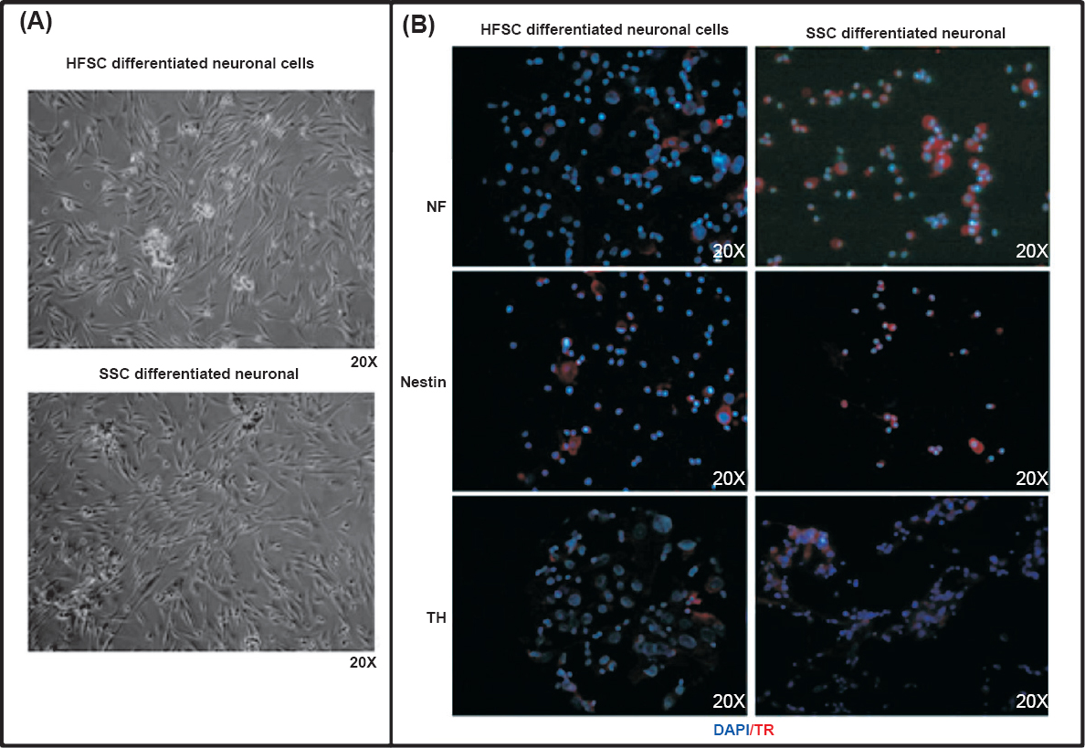 Differentiation of SSCs and HFSCs cells into neuronal cells and their characterization. (A). Photomicrographs depicting differentiation of SSCs and HFSCs into neuronal cells. (B). Immunofluorescence image of SSCs and HFSCs derived neuronal cells stained neuronal cell specific markers NF, nestin and TH antibody. DAPI (blue colour) was used as a nuclear stain. The secondary antibody was conjugated with Texas red (red colour).