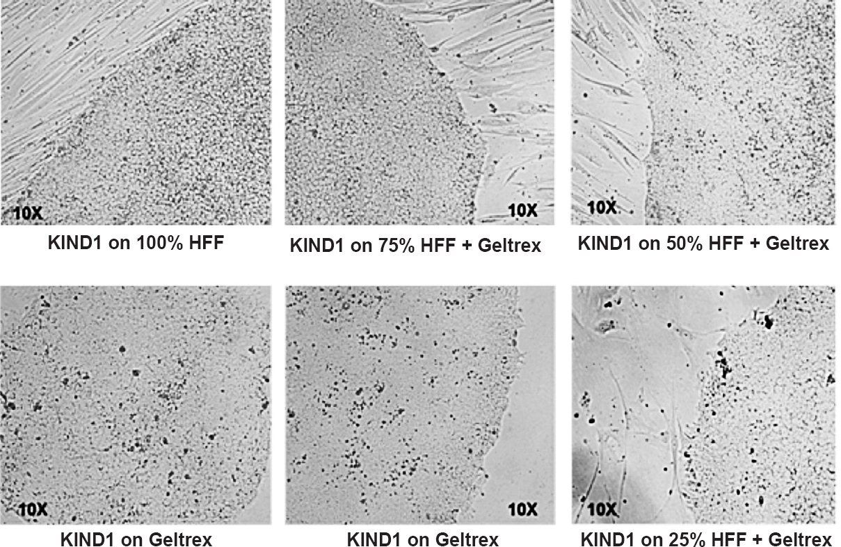 Establishment of feeder-free culture of human embryonic stem cell. KIND1 cells growing on human feeder fibroblasts (HFF) were transitioned to feeder-free culture system by gradually reducing feeder density while maintaining the concentration of Geltrex (synthetic extracellular matrix).