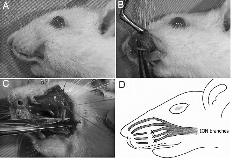 Surgical technique. (A) Incision following the anatomy of the upper lip. (B) Exposure of the main infra orbital nerve (ION) branches. (C) Nerve ligation and subsequent removal of the distal segment. (D) Scheme of the ligation and 2 mm segment removal in the three more distal ION nerve branches: “X”. Dotted line: incision.