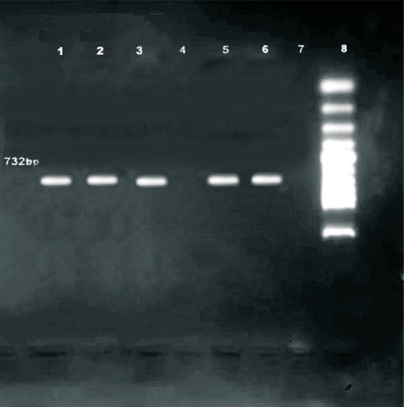 Agarose gel electrophoresis showing amplification of 723 bp fragment for vanA of VRE from the clinical samples. Lanes 1-3, 5-6: VRE strains represents the vanA amplified 732 bp fragment, Lane 7 - E. faecium ATCC 29212 (negative control), Lane 8-100 bp ladder marker.