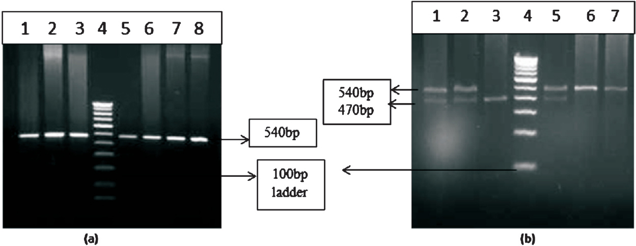 Gel pictures of BCL11A gene polymorphism. (a) Lanes 1, 2, 3, 5, 6, 7 and 8 represent the amplified product of BCL11A gene and lane 4 represents 100 bp ladder. (b) restriction fragment length polymorphism (RFLP) of BCL11A gene polymorphism. Lanes 1, 2 and 5 represent heterozygous condition 6, and 7 represents homozygous condition. Lane 3 represents homozygous mutant.