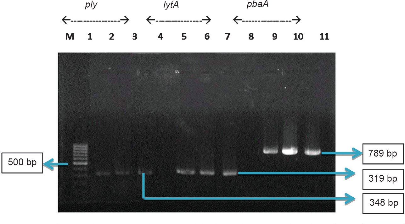 Pneumolysin (ply), autolysin (lytA) and modified penicillin binding protein (pbpA) genes amplified in the two isolates from cases of fatal pneumococcal infection. Amplicon sizes: ply - 348 bp; lytA - 319 bp and pbpA - 789 bp. M - 100 bp ladder (Gene ruler); Lanes 1, 5, 9; IBT-1960 (serotype 33C); Lanes 2, 6,10 - IBT -1975 (serotype 7C) and Lanes 3,7,11 - S. pneumoniae ATCC 49619; Lanes 4, 8, negative control.