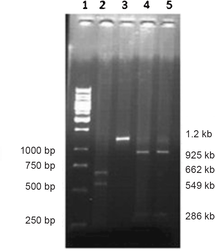 Electrophoresis band pattern by KpnI and BamHI digestion. Lane 1: 1kb DNA ladder, lane 2: KpnI digestion (wild), lane 3: KpnI digestion (mutant), lane 4: BamHI digestion (wild), lane 5: BamHI digestion (wild).