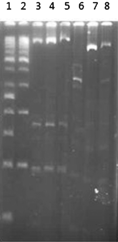 Electrophoresis band pattern by MspI and FokI digestion. Lane 1: 50bp DNA ladder, lane 2: 100bp DNA ladder, lanes 3-5: MspI digestion (wild), lane 6: FokI digestion (wild), lane 7: FokI digestion (mutant), lane 8: FokI digestion (heterozygous).