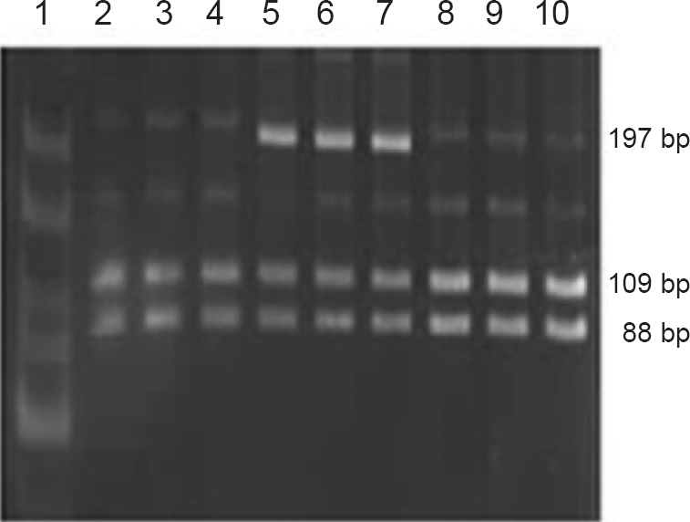 Electrophoresis band pattern by TaqI digestion. Lane 1: 25-300bp DNA ladder, lanes 2-4: TaqI digestion (wild), lanes 5-7: TaqI digestion (heterozygous), lanes 8-10: TaqI digestion (wild).