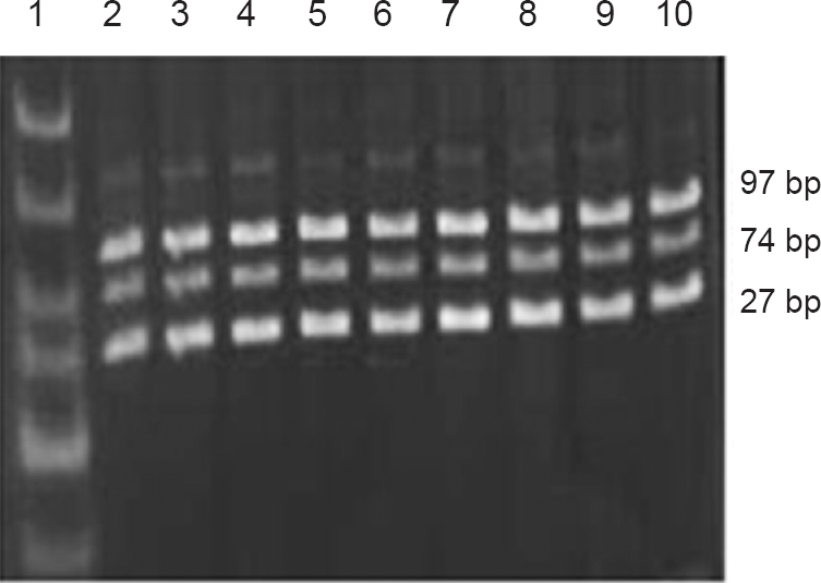 Electrophoresis band pattern by DdeI digestion. Lane 1: 25-300bp DNA ladder, lanes 2-10: DdeI digestion (mutant).