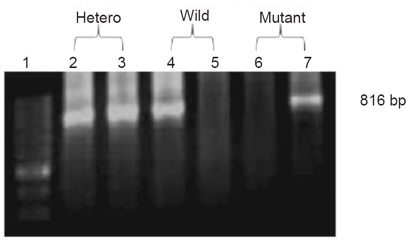Electrophoresis band pattern from allele-specific PCR for T341C site. Lane 1:100bp DNA ladder, lanes 2 and 3: heterozygous, lanes 4 and 5: wild, lanes 6 and 7: mutant.