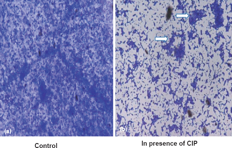 Representative photomicrograph (450 X) showing biofilm formed by P. aeruginosa on coveslip in presence (b) and absence of (a) sub-MIC of CIP. Arrows show chunks of biofilm observed in presence of CIP.