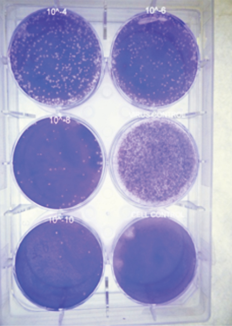 Six-well tissue culture plate showing DENV- 2 plaques. Plaques were observed in all the wells except in cell control well.