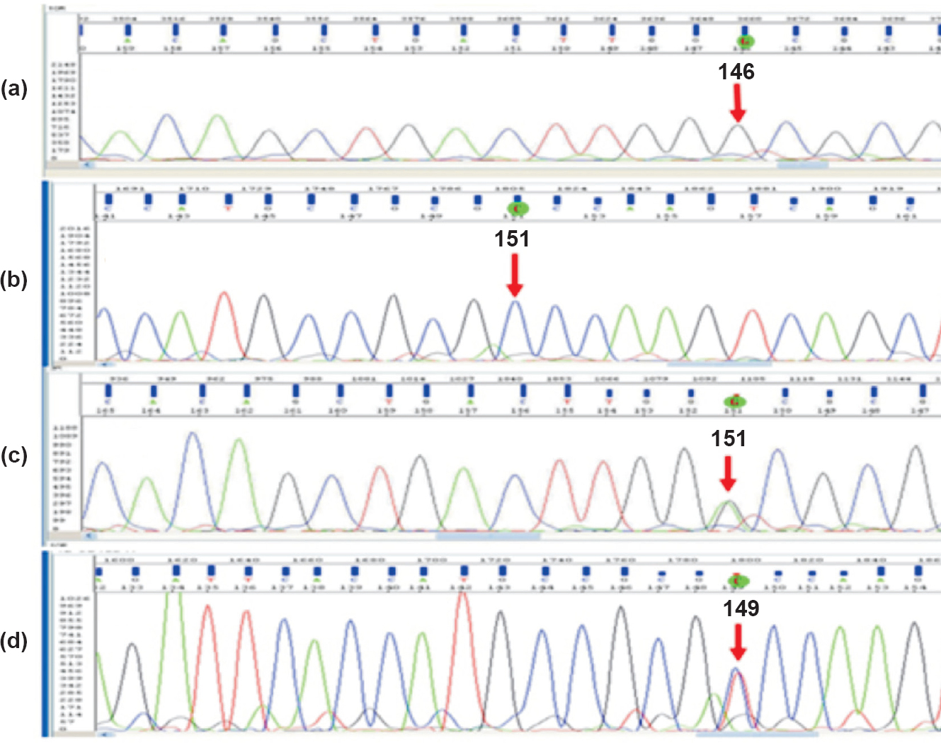 Sequencing of DNA containing homozygous and heterozygous (Ala67Thr) genotypes in poliovirus receptor. Sequences of fragment flanking nucleotide 499 of a homozygous sample with forward and reverse primers are presented in 3a, 3b and a heterozygous sample in 3c, 3d.