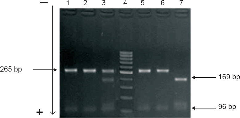 The FokI digestion profiles of the 265 bp PCR product of the VDR gene homozygous (CC) individuals showing an undigested 265 bp product (lands 1, 2, 5 and 6); heterozygous (CT) individuals showing 265, 196, and 69 bp fragments (lane 3); homozygous (TT) showing 196 and 69 bp fragments (lane 7). GeneRuler DNA ladder (1000-50 bp) (lane 4).