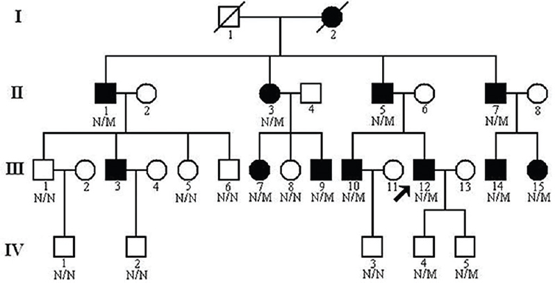 Pedigree of the family with autosomal dominant glomerulopathy. N, normal; M, collagen type IV alpha-4 c.3213delA mutation. Arrow indicates the proband.