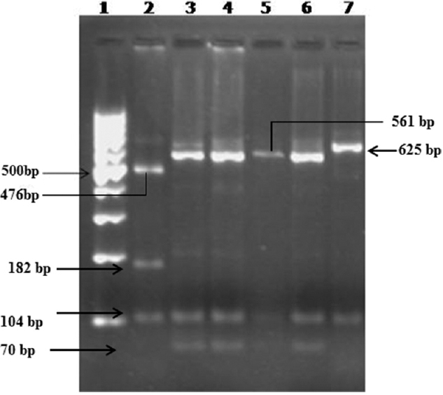 Restriction fragment length polymorphism using AseI RE for SSUrRNA gene. Lane 1-100 bp DNA ladder, lane 2 - Cryptosporidium felis control (AseI-104, 182, 476 bp), lanes 3, 4 - C. parvum (monkey genotype - AseI-70, 104, 559 bp), lanes 5, 6 - C. hominis, lane 7 - C. parvum (bovine genotype-AseI-104, 625 bp).