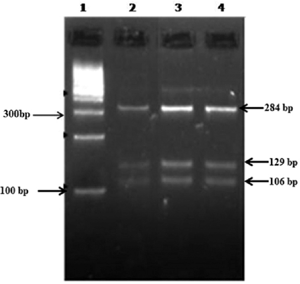 Restriction fragment length polymorphism assay using RsaI RE for Cryptosporidium oocyst wall protein gene. Lane 1 - 100 bp DNA ladder, lanes 2, 3, 4 - Cryptosporidium hominis isolates (RsaI - 284, 129, 106 bp).