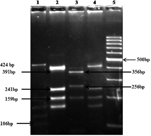 Restriction fragment length polymorphism assay using RsaI RE for Cpgp40/15 gene. Lane 1 - Ie isolates (424, 159, 134, 129, 106 bp), lanes 2, 4 - Ia (391, 241, 159, 143 bp), lane 3 - IIc (356, 256, 143 bp), lane 5 - 100 bp DNA ladder.