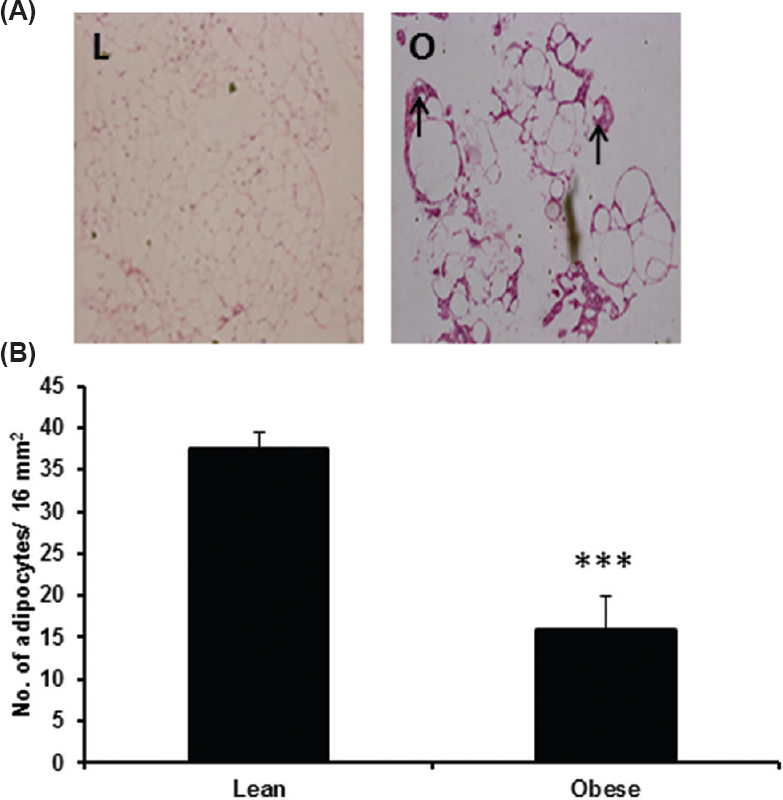 Adipose tissue histology in four month old, male WNIN/Ob lean and obese rats. (A) Photographs of H&E stained retroperitoneal adipose tissue to study adipocyte size and inflammation. ‘L’ indicates lean sample and ‘O’ indicates obese sample. Arrow marks indicate the presence of infiltrated inflammatory cells. (B) Adipocyte size calculated as a number of cells/16 mm2 (n=4/phenotype). *** indicates P < 0.001 compared to lean rats.