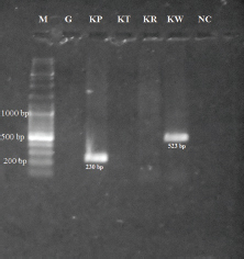 Agarose gel electrophoresis of amplified DNAs by nested polymerase chain reaction with serotype-specific primers. M: 1kb DNA ladder (Fermentas, code no. #SM0331); G, Gilliam; Kp, Karp; Kt, Kato; Kr, Kuroki; Kw, Kawasaki; NC, Negative control.