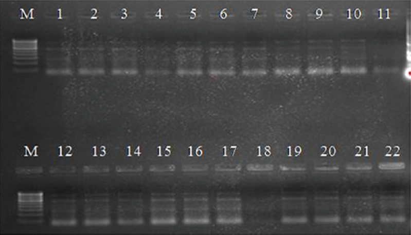 Molecular typing of K. pneumoniae isolates by ERIC PCR. Lane M: 100 bp ladder, lanes 1-18: Clinical isolates, lanes 19-22: Environmental isolates.